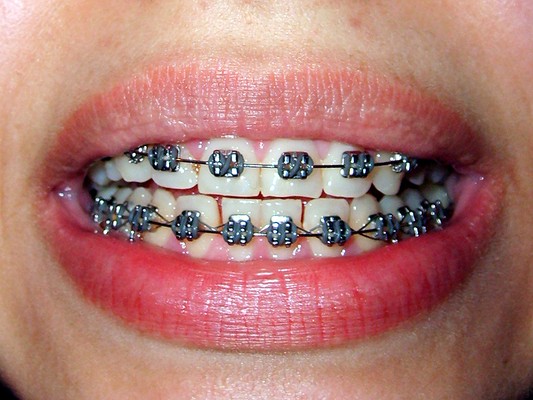 images/ortodonta.jpgaa111.jpg